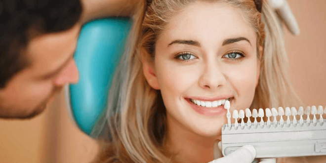 What Are Teeth Veneers and How Can a Dentist Help?