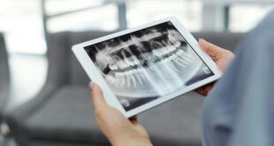 Dental X-Rays