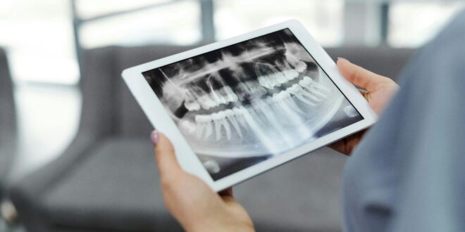 Dental X-Rays